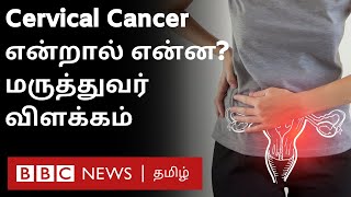 பெண்களை பாதிக்கும் புற்றுநோய்கள் என்னென்ன? FAQs on Cancers affecting women | Gynaecologist explains