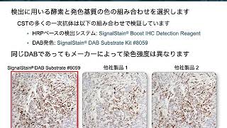 免疫組織化学染色 (IHC) の基礎：第4回 検出・脱水・封入および観察