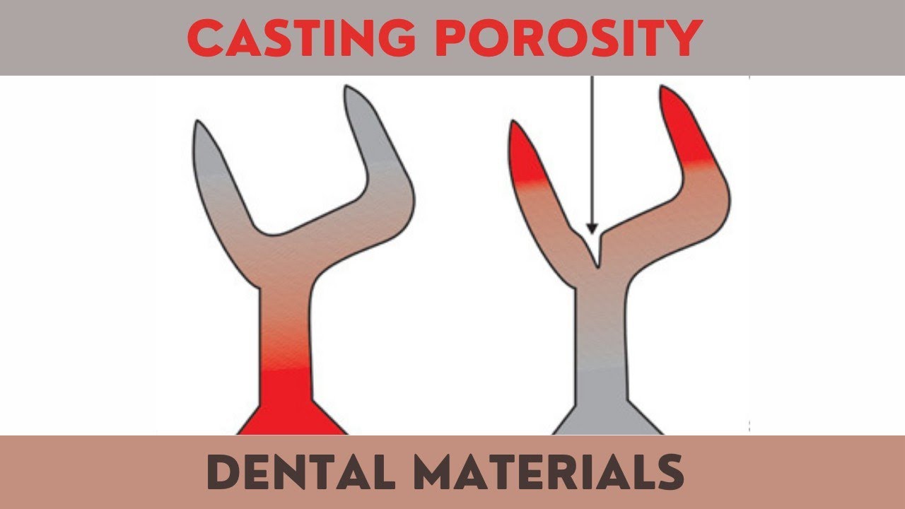 Types Of Casting Porosity Suck Back Pinhole Casting Defects Youtube