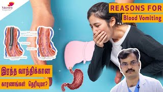 Reasons for blood vomiting | இரத்த வாந்திக்கான காரணங்கள்