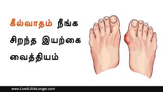 கீல்வாதம் நீங்க சிறந்த இயற்கை மருத்துவம் | Best Home Remedy For Gout