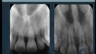 Anatomía radiográfica normal 1.Normal radiographic anatomy 1