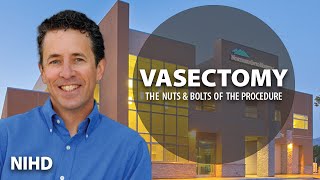 Vasectomy: The Nuts and Bolts of The Procedure