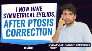 The Best treatment Options for Droopy Eyelids (Ptosis) | Patient experience | Ptosis treatment