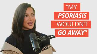 Kim Kardashian’s Health Confession: How She Conquered Psoriasis and Embraced Self-Care