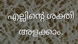 Bone health Malayalam.എല്ലിന്റെ ശക്തി ഒന്ന് ചെക്ക് ചെയ്യാം. Malayalam health tips