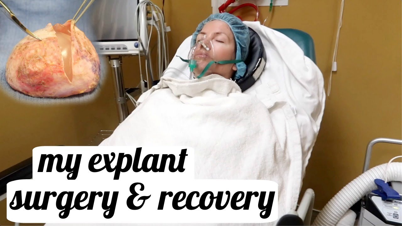 My Explant Surgery & The Recovery (hour Long Video Of What It Is Really ...