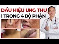 Dấu Hiệu Ung Thư - 1 trong 4 bộ phận này chuyển sang màu đen | Bác Sĩ Trần Minh