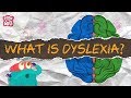 DYSLEXIA | What Is Dyslexia? | Learning Disability | The Dr Binocs Show | Peekaboo Kidz