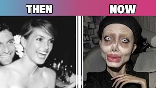 10+ Celebrity Plastic Surgery Disasters You Won’t Believe | Then and Now 2025
