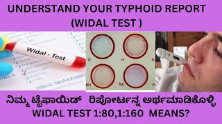 UNDERSTAND YOUR TYPHOID TEST(WIDAL TEST ) REPORT.POSITIVE/NEGETIVE  TYPHOID REPORT.TITRE 1:80.1:160