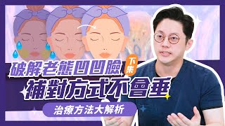 破解老態凹凹臉/臉頰凹陷！補對方式不會垂(下集)｜周杰醫師