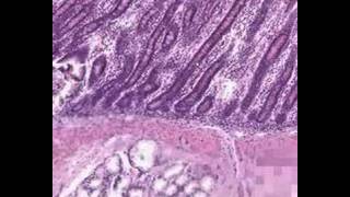 Shotgun Histology Duodenum