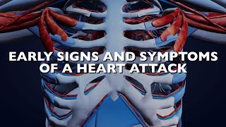 Healthy Living: Signs of a Heart Attack