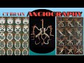 CT Brain Angio Full Procedure In Hindi On Toshiba Aquilion 64 Slice. GE ADW 4.6