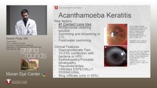 A Case of Acanthameoba Keratitis