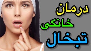 تبخال چیست و ساده ترین روش درمان تبخال در خانه