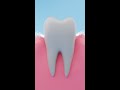 The Importance of Early Detection for Gum Disease