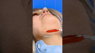 What Really Happens In A Facelift