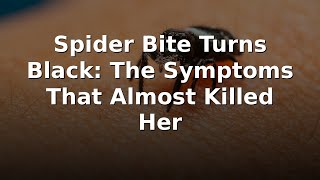 Spider Bite Turns Black: The Symptoms That Almost Killed Her