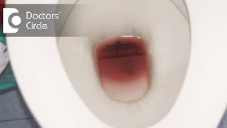 Reasons why you shouldn't ignore Rectal bleeding - Dr. Rajasekhar M R