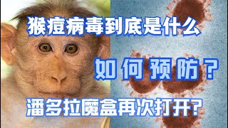 “猴痘”病毒到底是什麼？如何預防？潘多拉魔盒再度被打開？