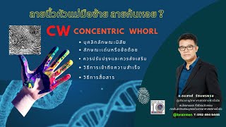 รู้จักตัวตนคนมีลายนิ้วก้นหอยที่หัวแม่มือซ้ายชนิด CW (Concentric Whorl) 2/2