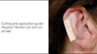 Mepilex Border Lite - application on ear