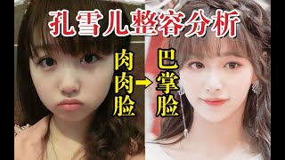 【孔雪儿】磨骨？假下巴！花7年拥有的韩国女团脸究竟成功还是失败？