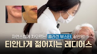 자연스럽게 젊어지는 시술을 찾는다면? ㅣ 레디어스 시술 과정 공개 [전후 공개]