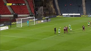 Hibernian's Kevin Nisbet misses crucial penalty in Scottish Cup semi-final