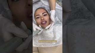 Красивая кожа без фильтров и фотошопа: HydraFacial —  современное чудо косметологии ⭐️