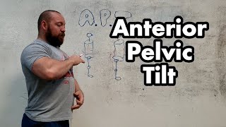 Anterior Pelvic Tilt and Bracing: How to Fix APT, Increase Bracing and Eliminate Low Back Pain