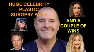 3 Huge Celebrity plastic surgery FAILS. And 2 successes.