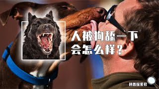 人被狗舔了一下，会发生什么可怕的事情？会得狂犬病丢掉性命吗？