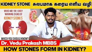 சிறுநீரக கல் சுலபமாக கரைய எளிய வழி | Kidney stone treatment