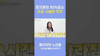 피지분비 80%감소하는 모공 시술