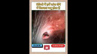 breathing difficulty in winter season #shorts #youtubeshorts #viral