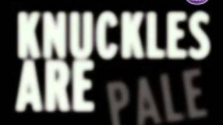 1η Δεκεμβρίου - Παγκόσμια Ημέρα κατά του AIDS