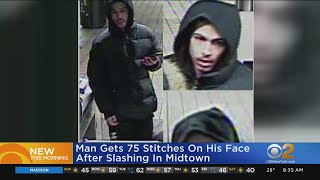 Man Gets 75 Stitches On His Face After Slashing In Midtown