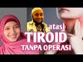 Atasi penyakit tiroid tanpa operasi || Resep jsr dr Zaidul Akbar penyakit tiroid || biidznillah