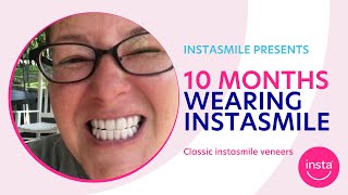 instasmile 10 month update | Clip on veneers | classic BL1 instasmile