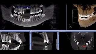 РуДента. Компьютерная томография. Видеть невидимое.