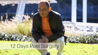 Hip Replacement | SuperPATH Technique