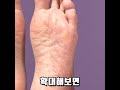 보고도 믿을 수 없는 발각질제거제 실제 리뷰