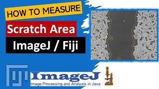 Scratch assay | Wound Healing Assay | Cell Migration Assay | ImageJ Software | Image Processing