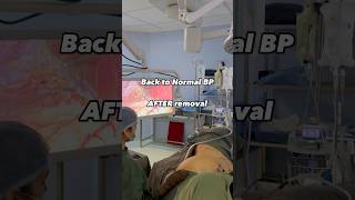 BACK TO NORMAL BP - Is it possible ? after adrenal tumor removal operation ? Adrenal adenoma surgery