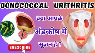 क्या आपको पेशाब में दर्द एवं जलन होती है? Gonococcal Urethritis | अंडकोष में सूजन है l