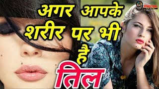 शरीर के इन अंगों पर है तिल, तो जल्द ही आप धनवान होने वाले हैं... | Meaning Of Moles On Body Parts