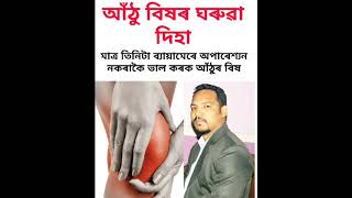 আঁঠু বিষৰ ঘৰুৱা দিহা/  Home remedy for knee osteoarthritis.